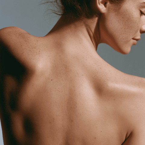 Topical application of ASA.P®